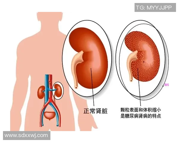 足球明星是否也会面临肾病风险及其健康管理的重要性探讨